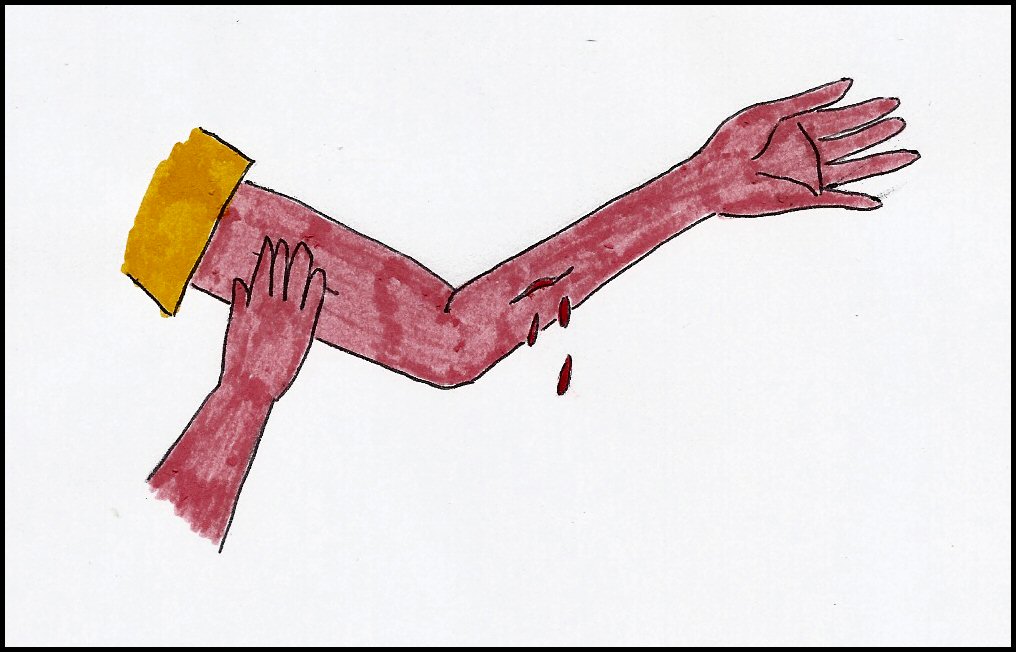 Emorragie? Niente di impossibile!